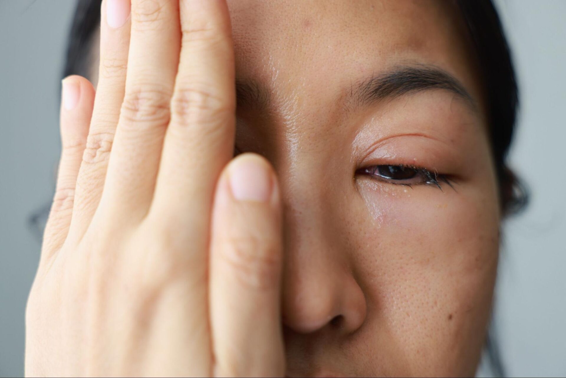 Can a globe injury heal on its own